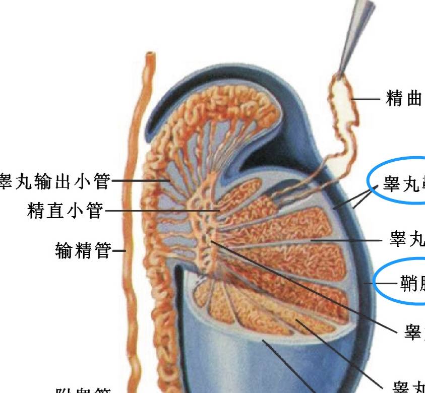 。鞘膜积液则是鞘膜腔内异常聚集的浆液，有先天性原因，也有后天原因。