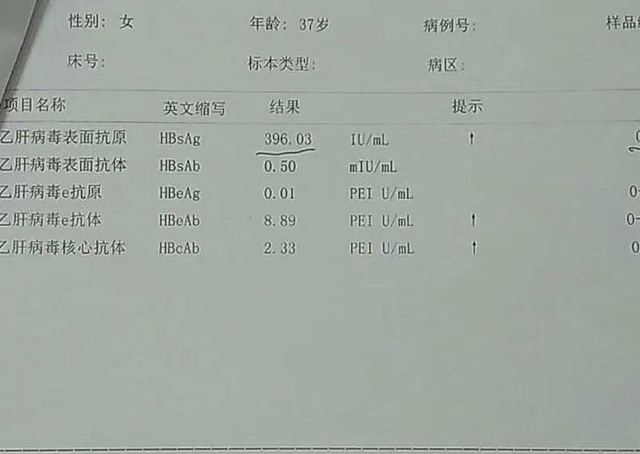 乙肝五项，表面抗原阳性，就一定是乙肝患者吗，携带者可能性更大_检查_hbsag_进行