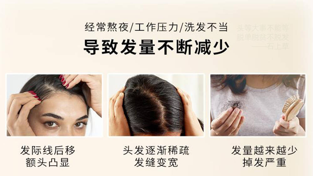 头发特别油脱发用什么洗发水？用了千万别嫌头发多!