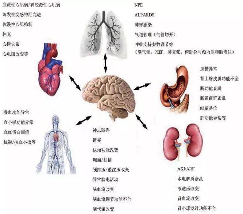 死地只有一招可以破解!脑组织被挤变形?这种快速置人于死地的危重状态