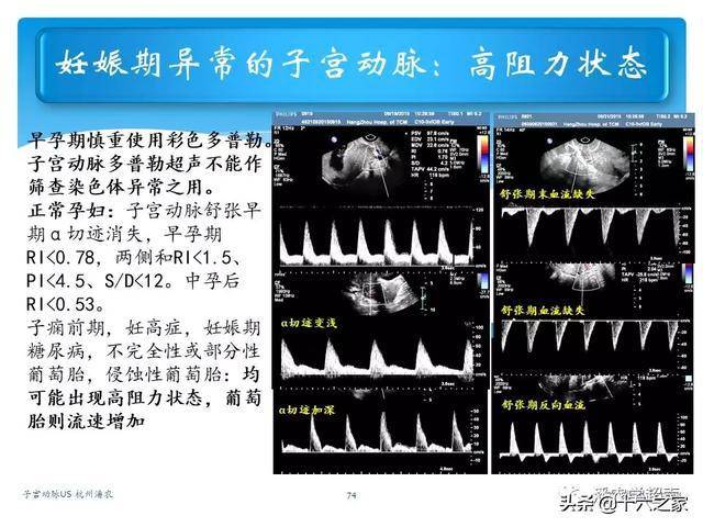 子宫动脉超声检查