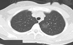 尿频尿急尿痛怎么缓解疼痛 d8a7758aa6994c13856f213afb554d29.jpeg