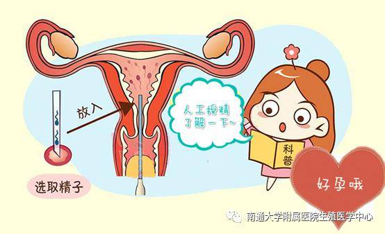 助孕神器——人工授精_手机搜狐网
