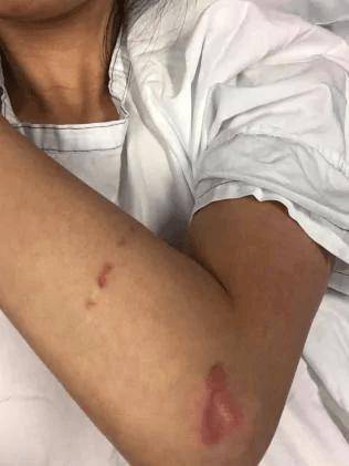 妈妈群聊新冠起分歧，澳洲两华女线下“约架”