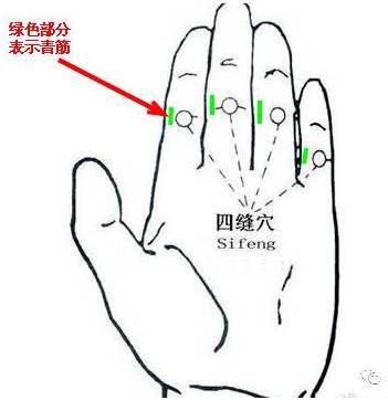 刺血治百病:扎四缝,很管用,操作熟练还不疼!