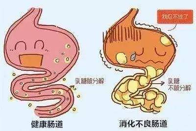 肠道菌群失调:2胃肠动力异常可能是婴儿肠绞痛的病因之一.