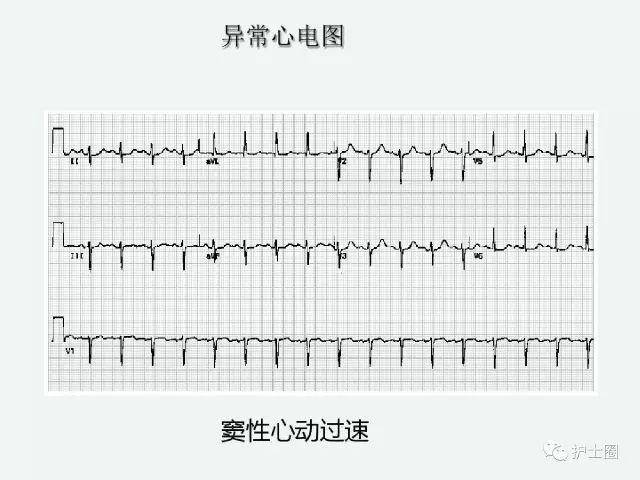 863f5215bf874190abb257c9bf7e4212.jpeg