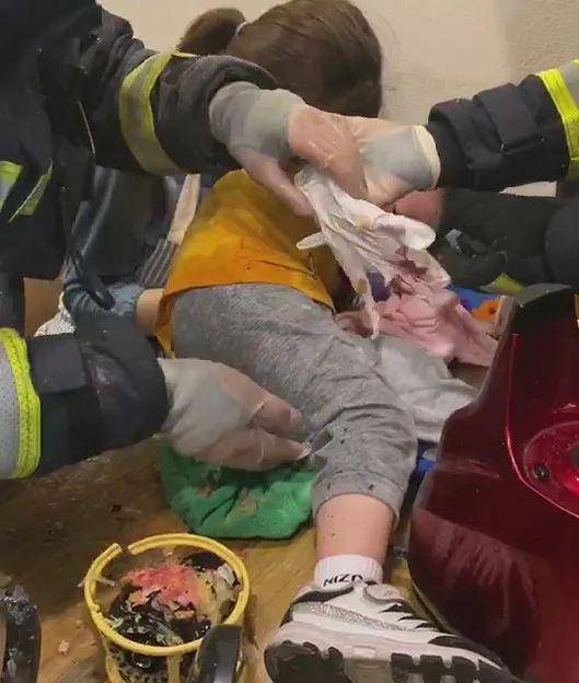 「孩子」太危险了！3岁男童模仿妈妈榨汁结果整只手臂卡进榨汁机