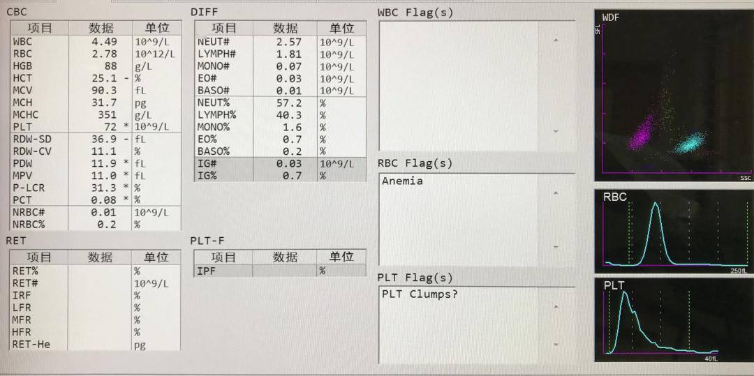 一例散点图异常的血常规报告分析