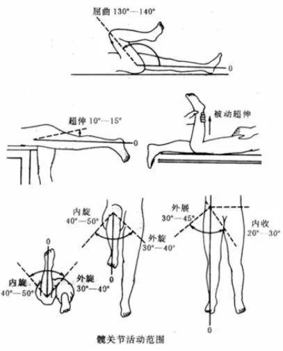 介绍髋关节如何检查?