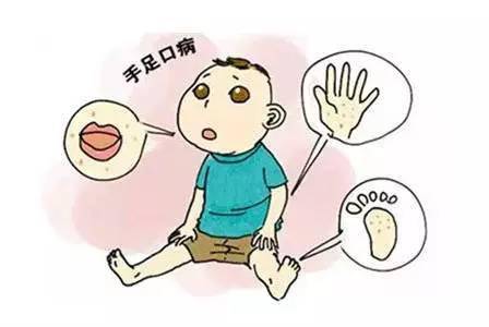 【科学保健】手足口病进入流行期,哪些预防必须做?