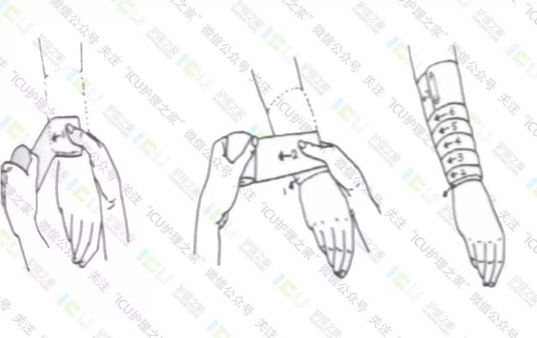 外伤急救四项技术_手机搜狐网