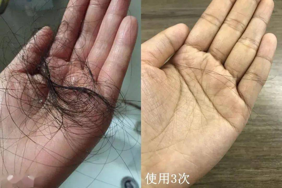 德国变态洗发皂,7天发量暴增!20天浓密乌黑!