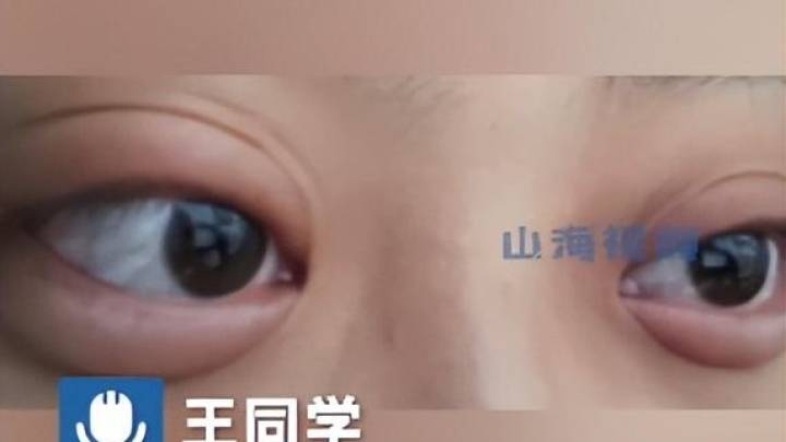 女生和男友吵架分手,哭3小时眼睛肿成悲伤蛙,你怎么看?