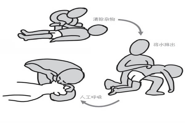 其次,及时清除呼吸道内的积水,宝宝意外溺水,首先需及时检查呼吸和