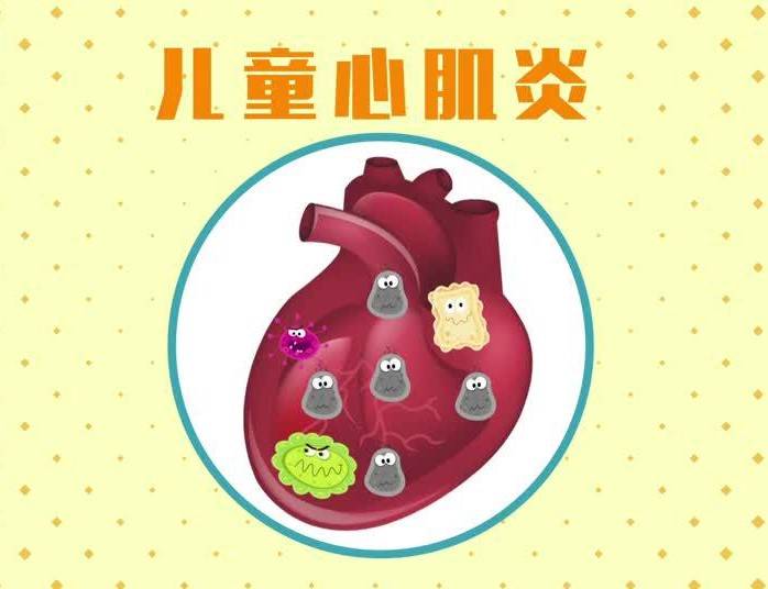 病毒感染是儿童心肌炎最常见病因_美国心脏协会