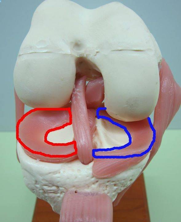 半月板损伤自测图