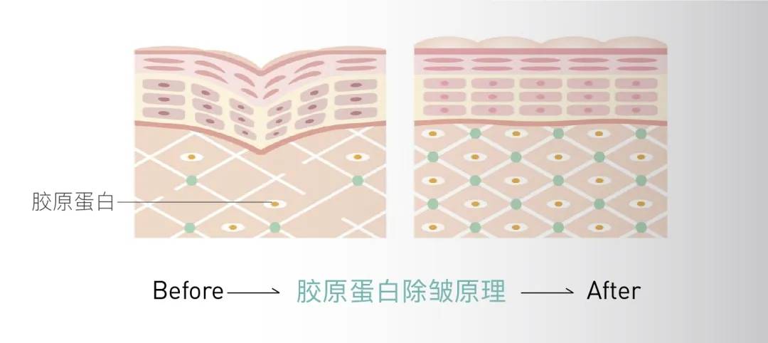 中科臻颜胶原蛋白逆龄肌肤护肤人源胶原蛋白三型