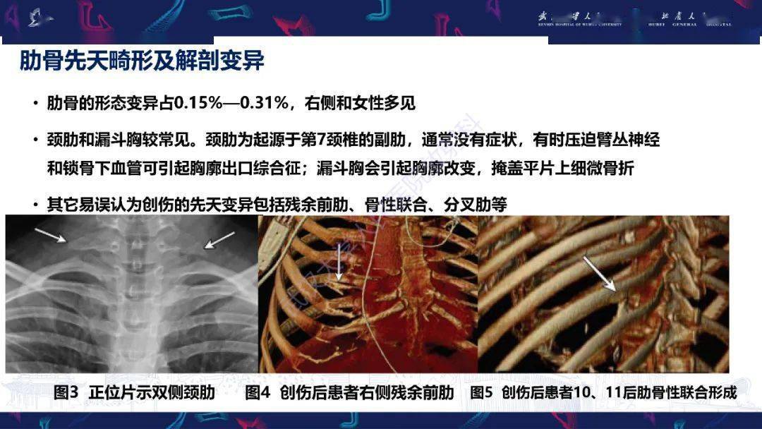 精彩推荐 肋骨病变影像诊断