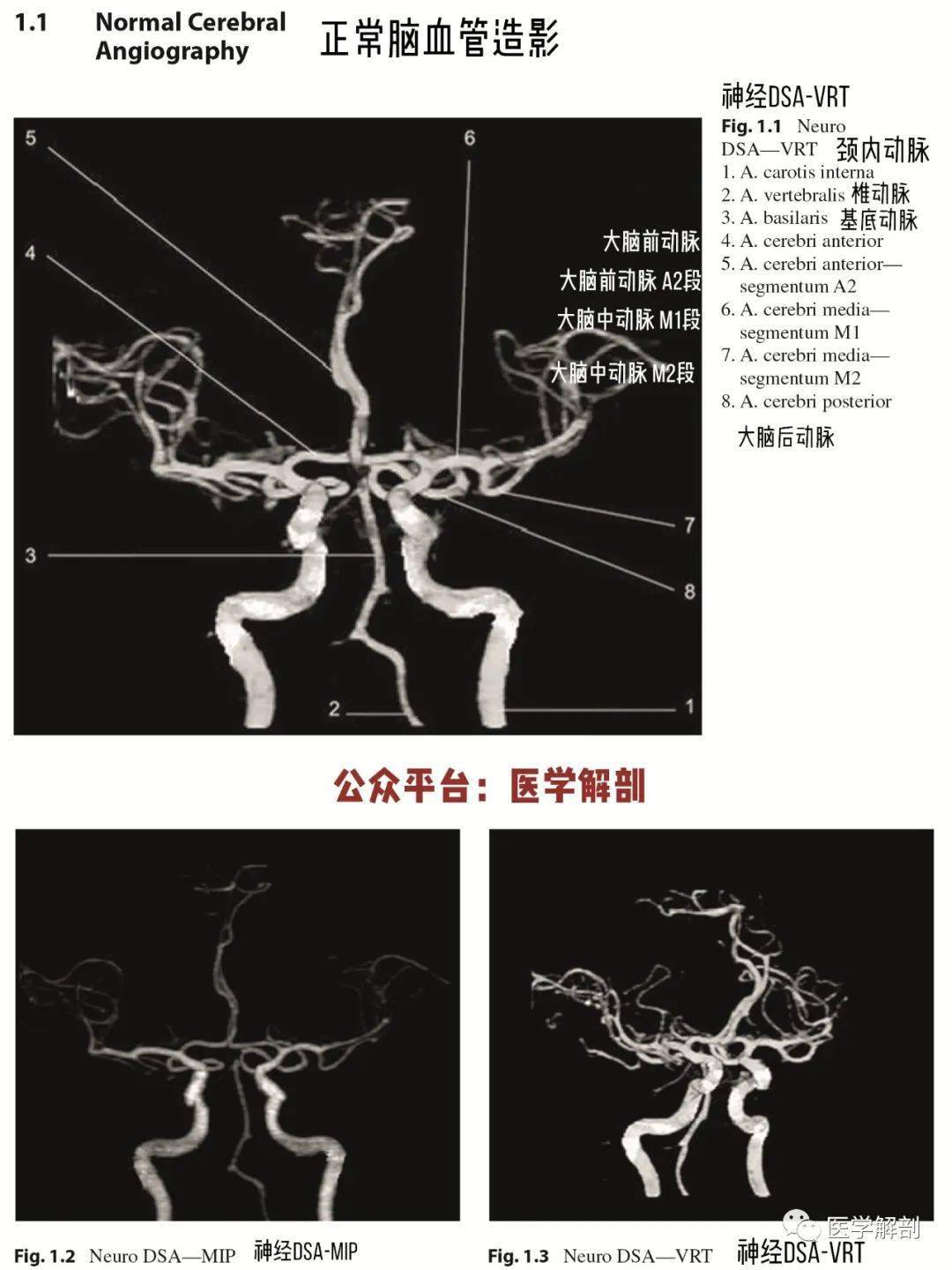 脑cta图谱正常大脑动脉造影