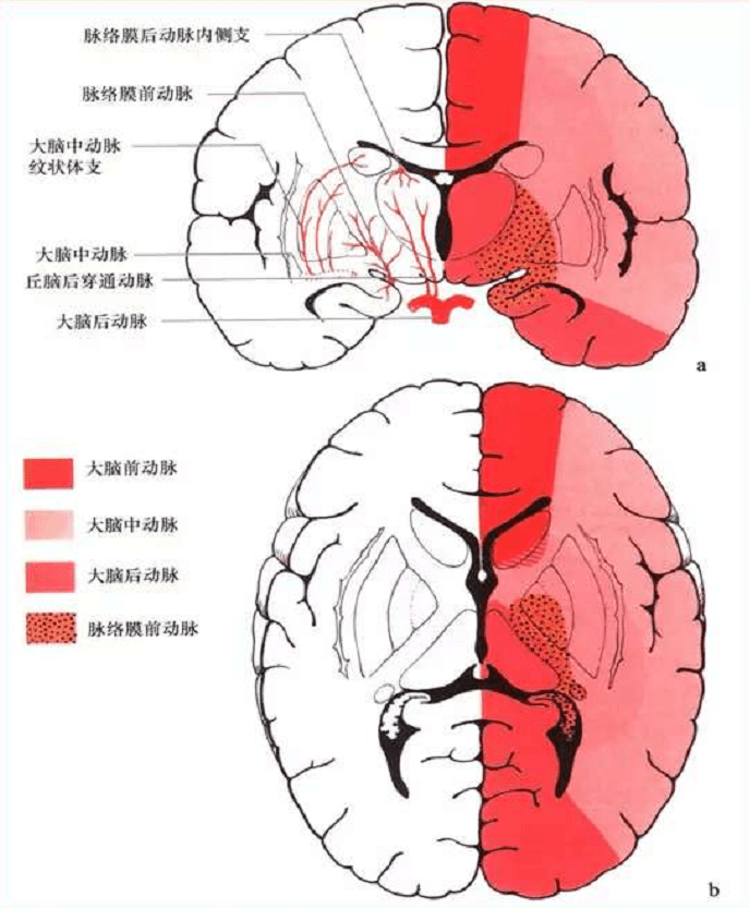 dais讲坛丨从基底节区脑动静脉畸形探讨基底节区血运