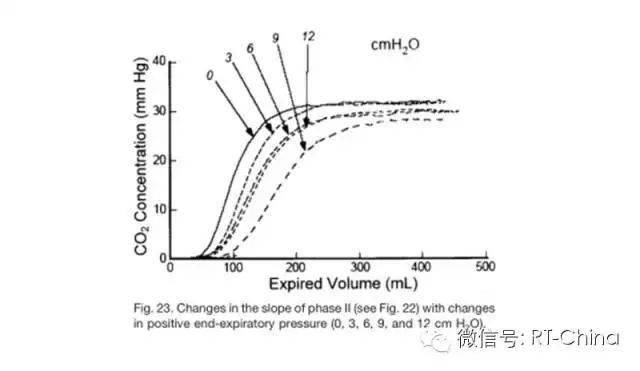 Breathing Patterns Diagram