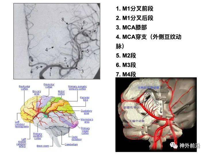 实用课件| 脑动脉分段与分支