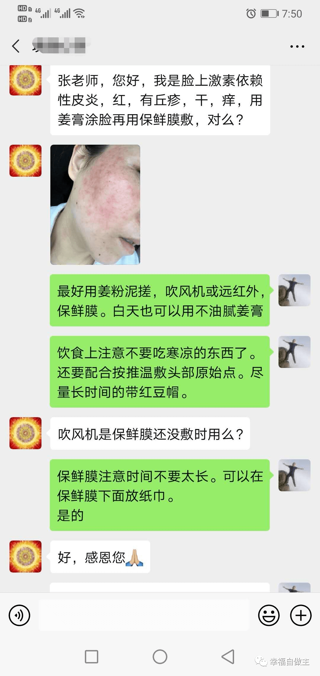 激素依赖性皮炎案例