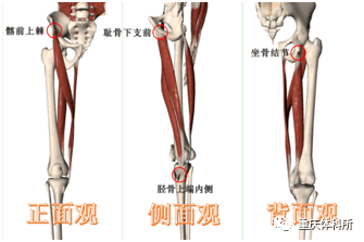 在鹅足肌腱下与胫骨之间有一滑囊,称为鹅足腱滑囊.