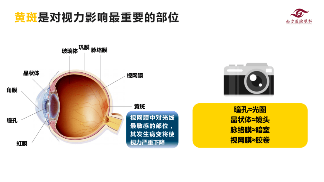 【科普】糖尿病性黄斑水肿——隐匿的视力杀手