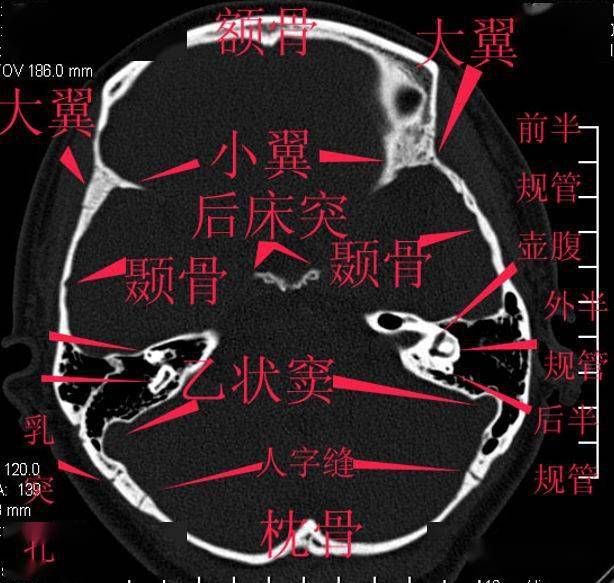 详细标注的颅底解剖