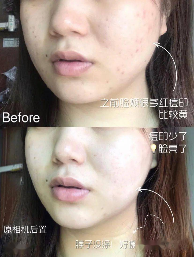 沈梦辰这脸变的!《乘风破浪》这皮肤状态,估计花了不少钱吧?