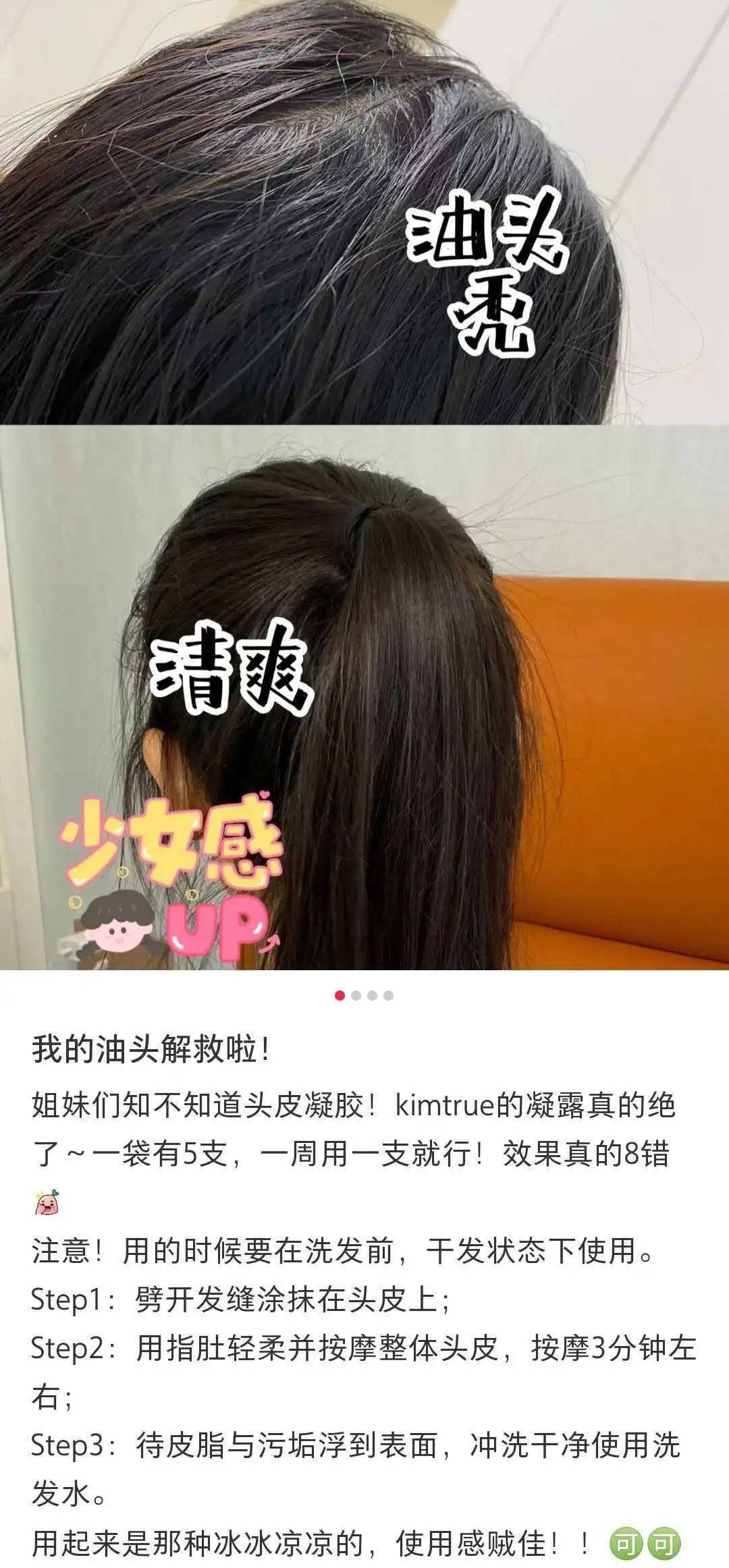 李佳琦推荐的脱发克星!一次就能拯救头屑头痒头油,用了它头发都会跳舞!