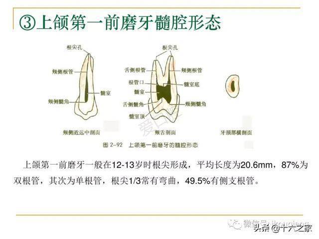 牙体髓腔解剖系统开髓开髓洞型及根管常用器械的认识和使用