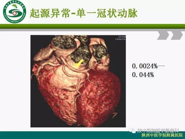 冠脉的正常解剖与变异
