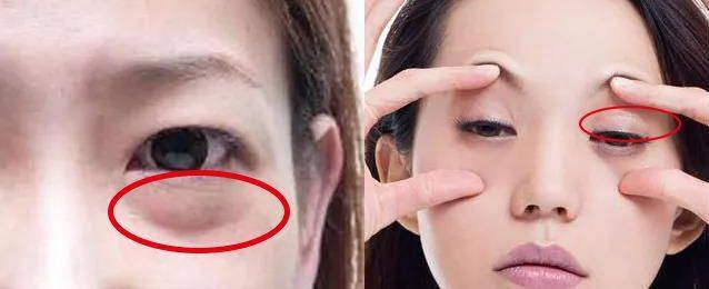 一片=10贴眼膜！解救“疲劳眼”！25分钟蒸走干黑眼圈，还你少女明眸