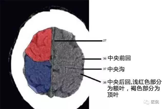 颅脑ct解剖口诀及彩色解剖图