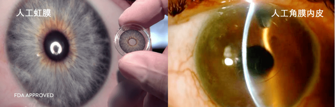 科研前线:人工视网膜组装的ec-eye仿生眼