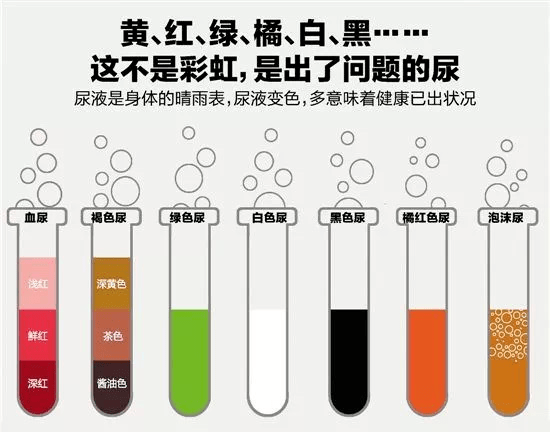 八,尿液颜色  喝水不多,但小便次数增多的话,要警惕尿崩症,糖尿病或