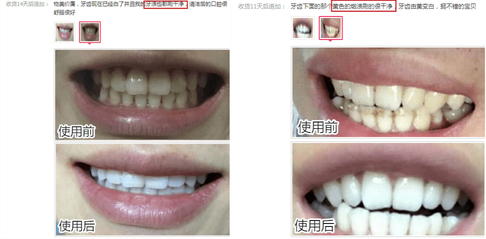怎么刷白牙最快 91d42aafdb2b4280aec466e735126ccd.png