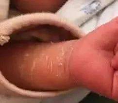 医生|医生发话了：宝宝这26个“怪现象”根本不是病！！别再动不动往医院跑了！