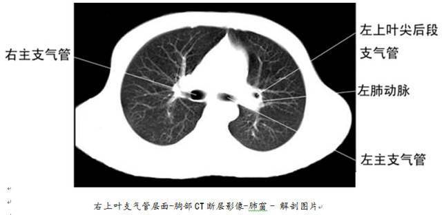 全身ct图谱 // 美国naha芳疗师认证考试