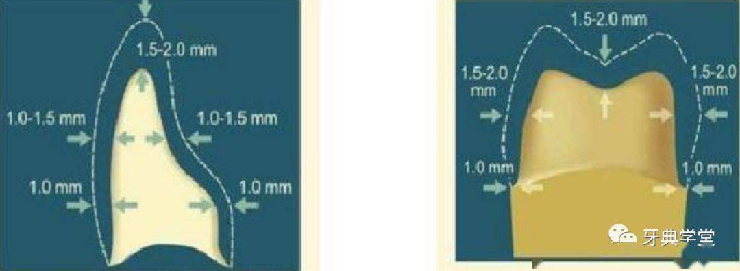 牙医学堂牙体预备操作参考