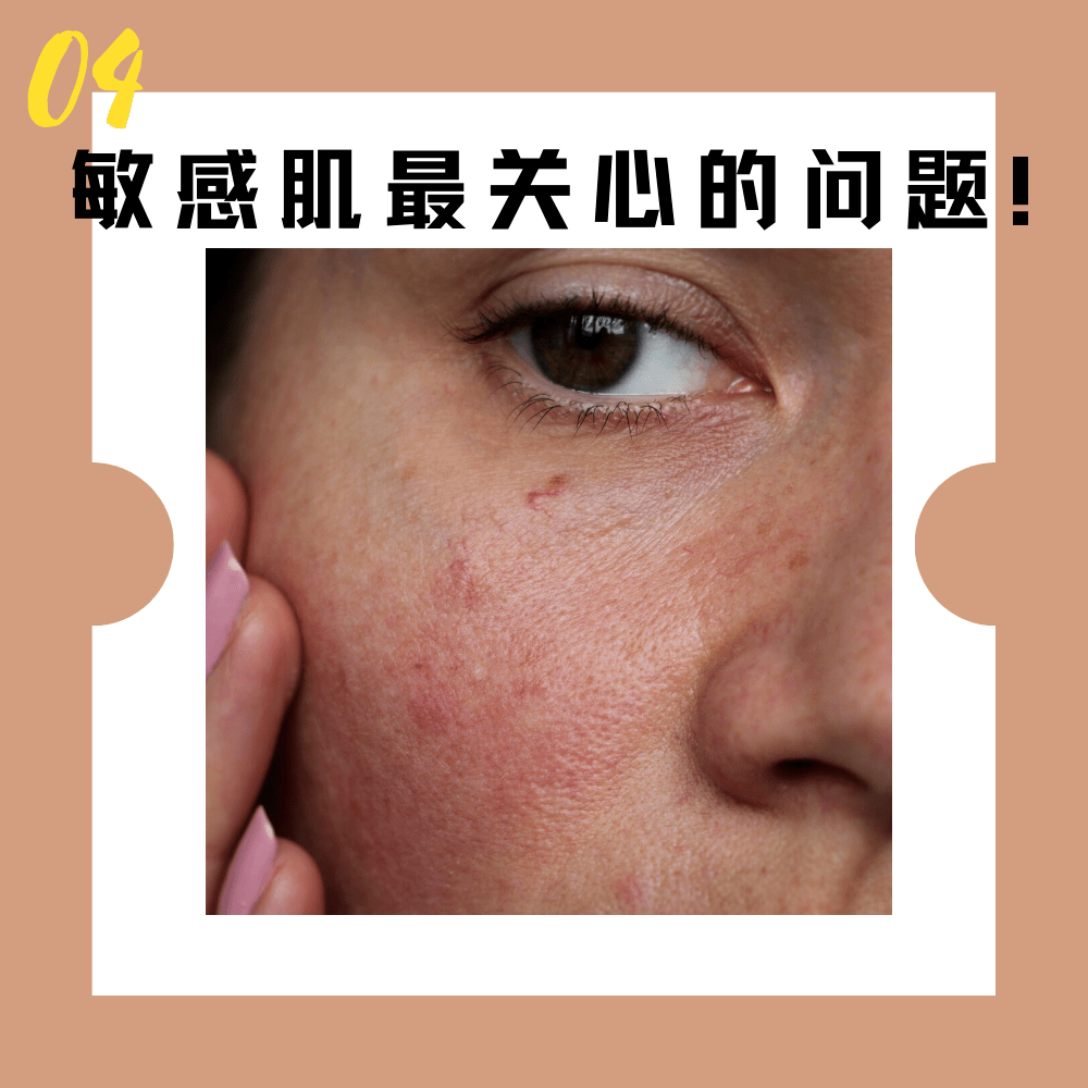 肌肤|傻子才听吴昕的敷三明治面膜！