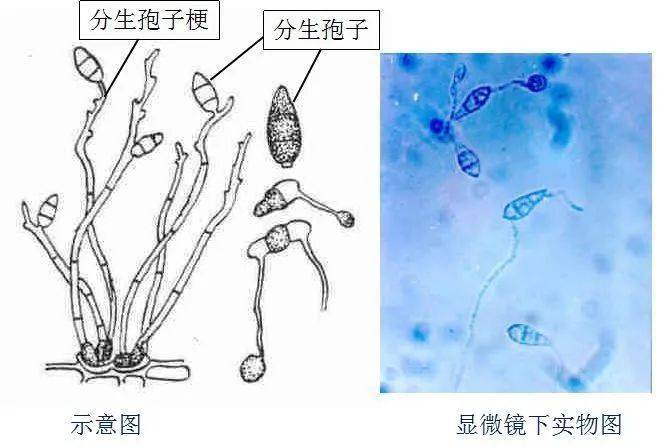 稻瘟病菌属于半知菌亚门梨形胞属,分生孢子梗不分枝,3-5根丛生,分生