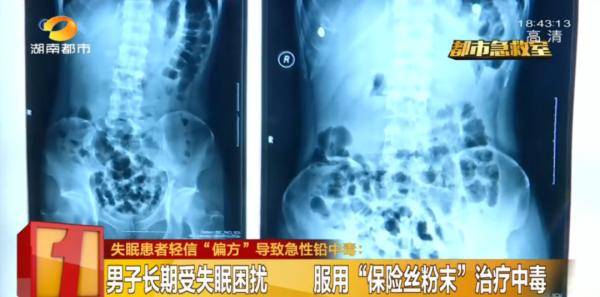 湖南|荒唐！失眠就吃保险丝？湖南男子听信邻居“偏方”，结果……