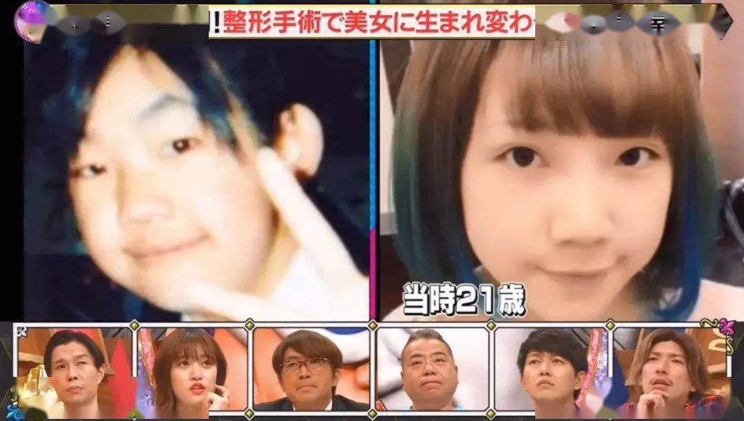 妹子|亲妈鼓励自己去整容，日本妹子10年间花600万大变身