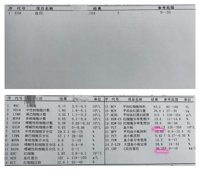 宝妈们注意了:这个像极了感冒的川崎病,误诊误终身!