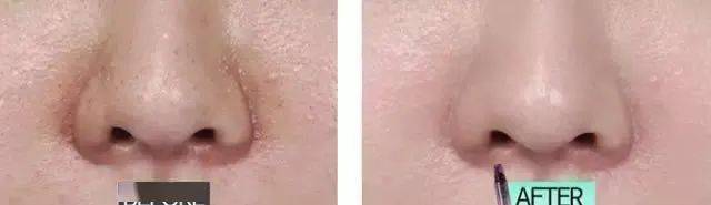 角质|能搓出“脏东西”的它3秒卖出一瓶！去角质、黑头、收毛孔，给你肌肤来次“大扫除”!