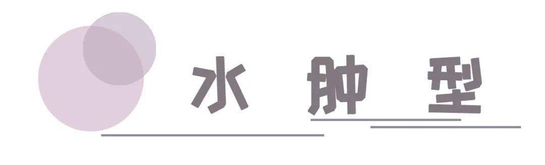 肌肉|全网打卡女团腿,没搞清楚这点也敢随便跟着练?